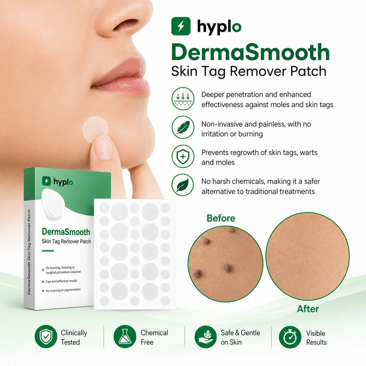 Skin Tag Remover Patches – Gentle, Painless Patches for Smoother-Looking Skin