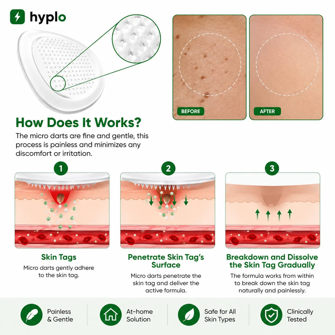 Skin Tag Remover Patches – Gentle, Painless Patches for Smoother-Looking Skin