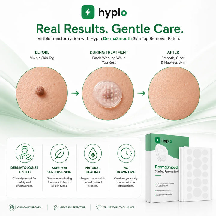 Skin Tag Remover Patches – Gentle, Painless Patches for Smoother-Looking Skin