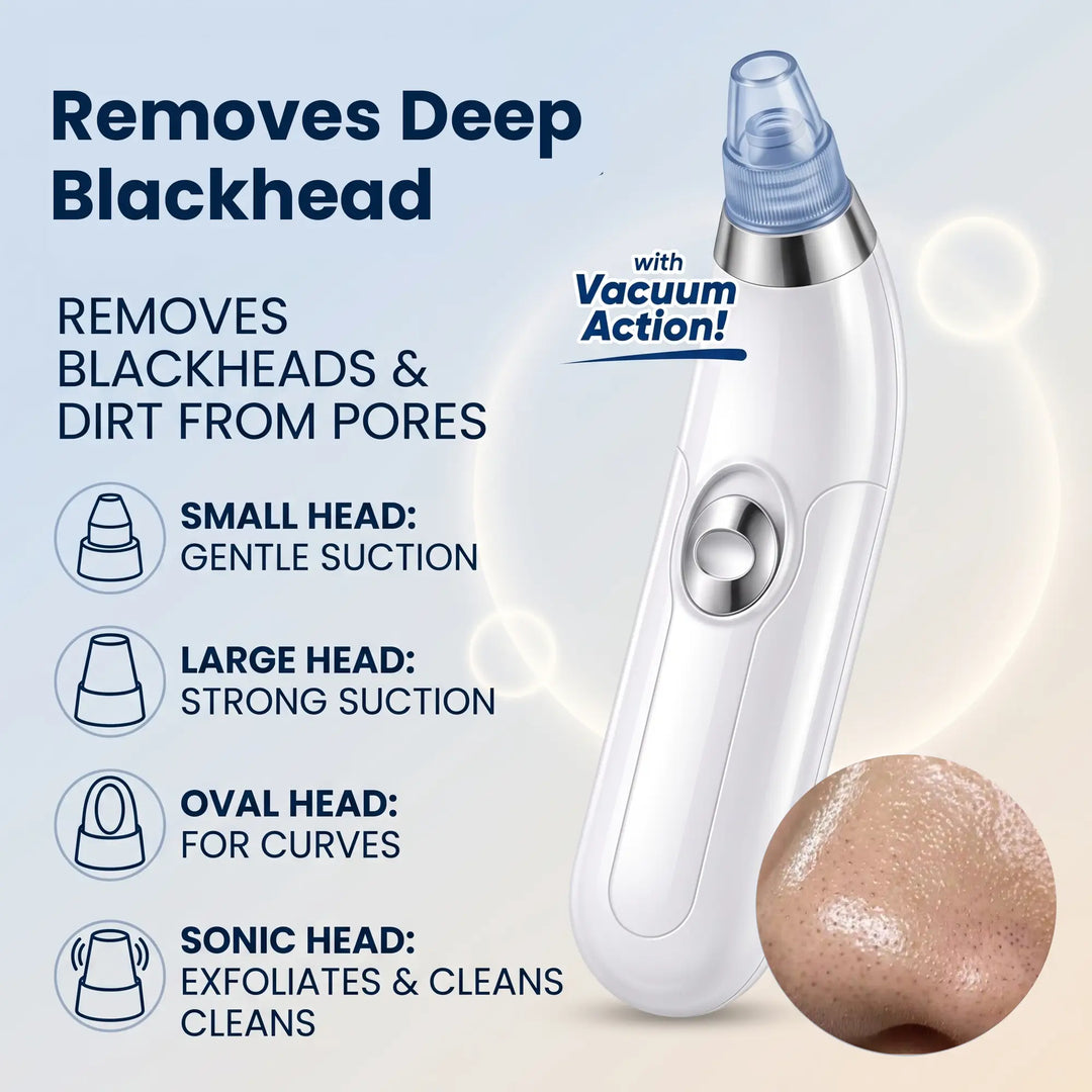 DermaSuction™ 4-in-1 Pore Vacuum – Blackhead Remover Tool