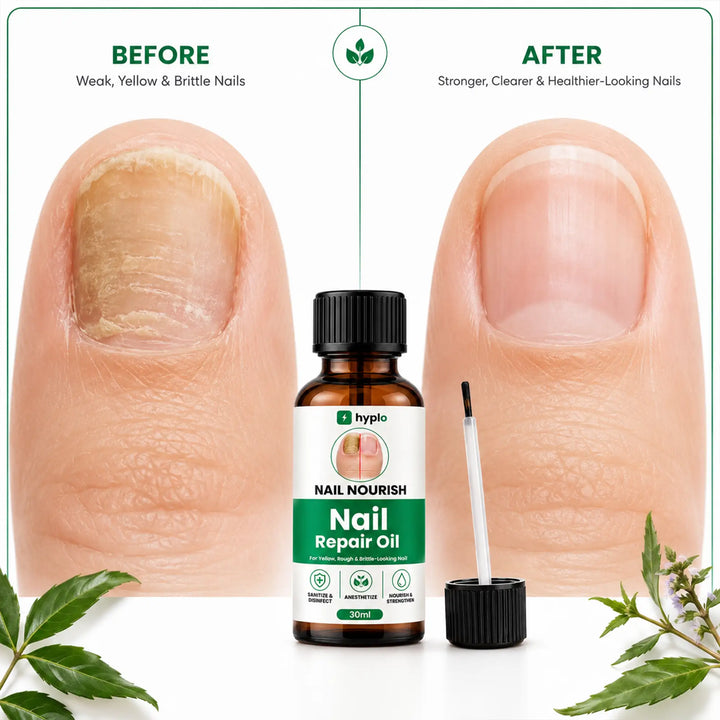 NailNourish™ Nail Repair Oil